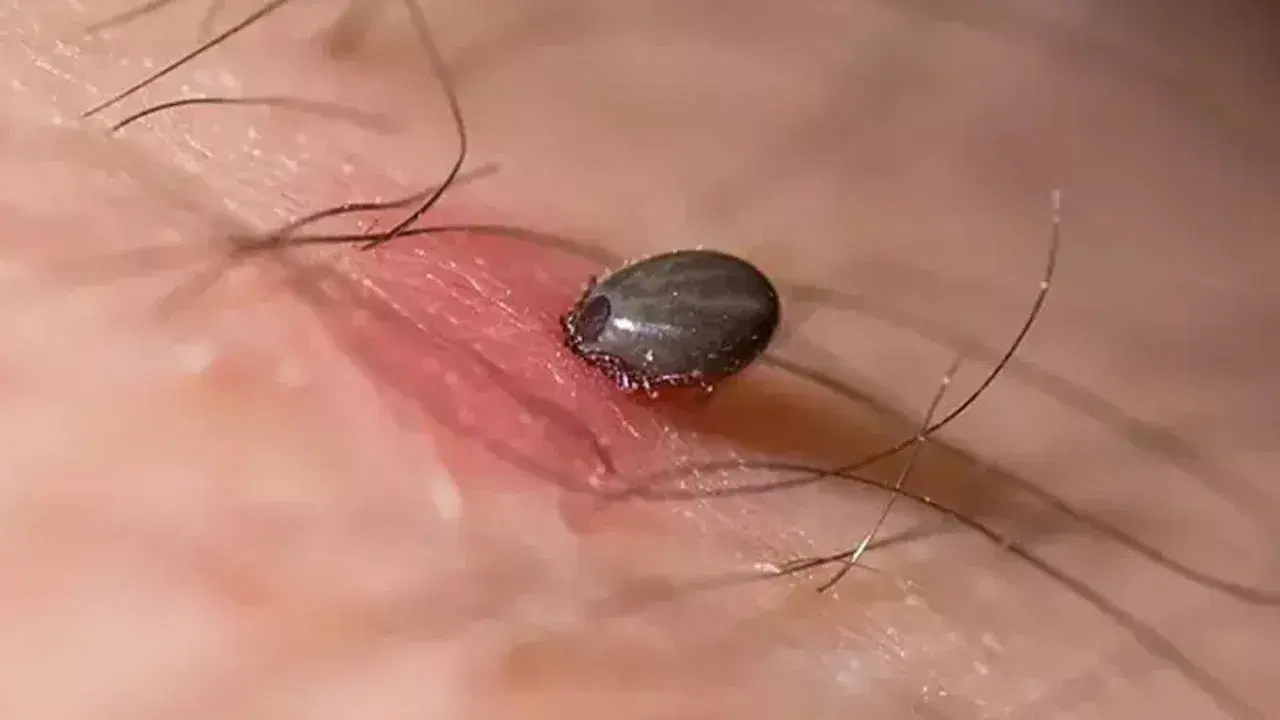 Tokat'ta KKKA hastalığı şüphesiyle tedavi gören kadın hayatını kaybetti